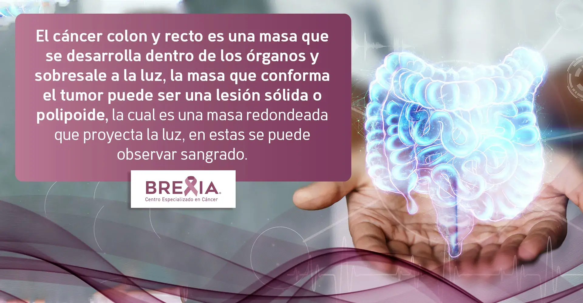 lesiones del cáncer de colon y recto