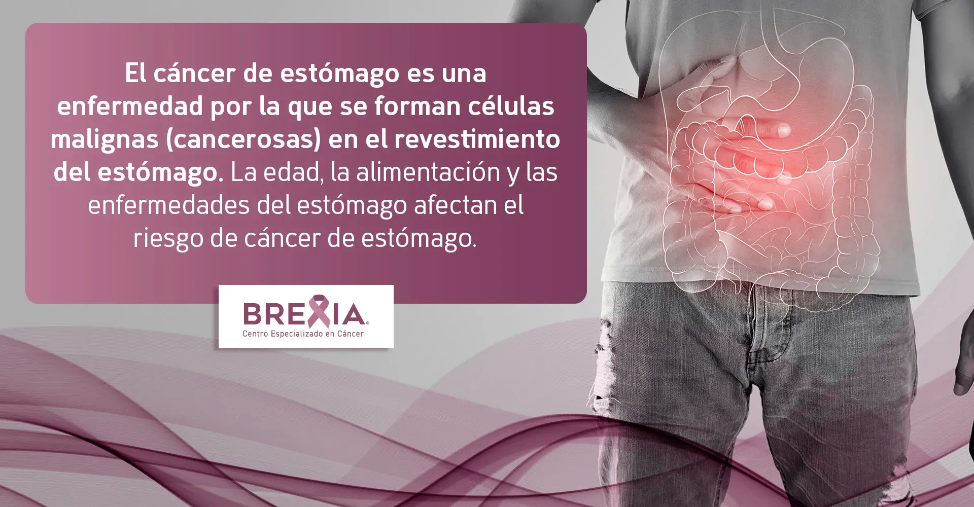 El cáncer de estómago es una enfermedad que forma células malignas en el revestimiento del estómago. (Riesgos por edad, alimentación)
