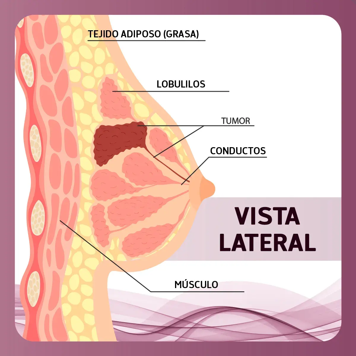 Vista de la anatomía de la mama (músculo, tejido adiposo, conductos, lobulillos)
