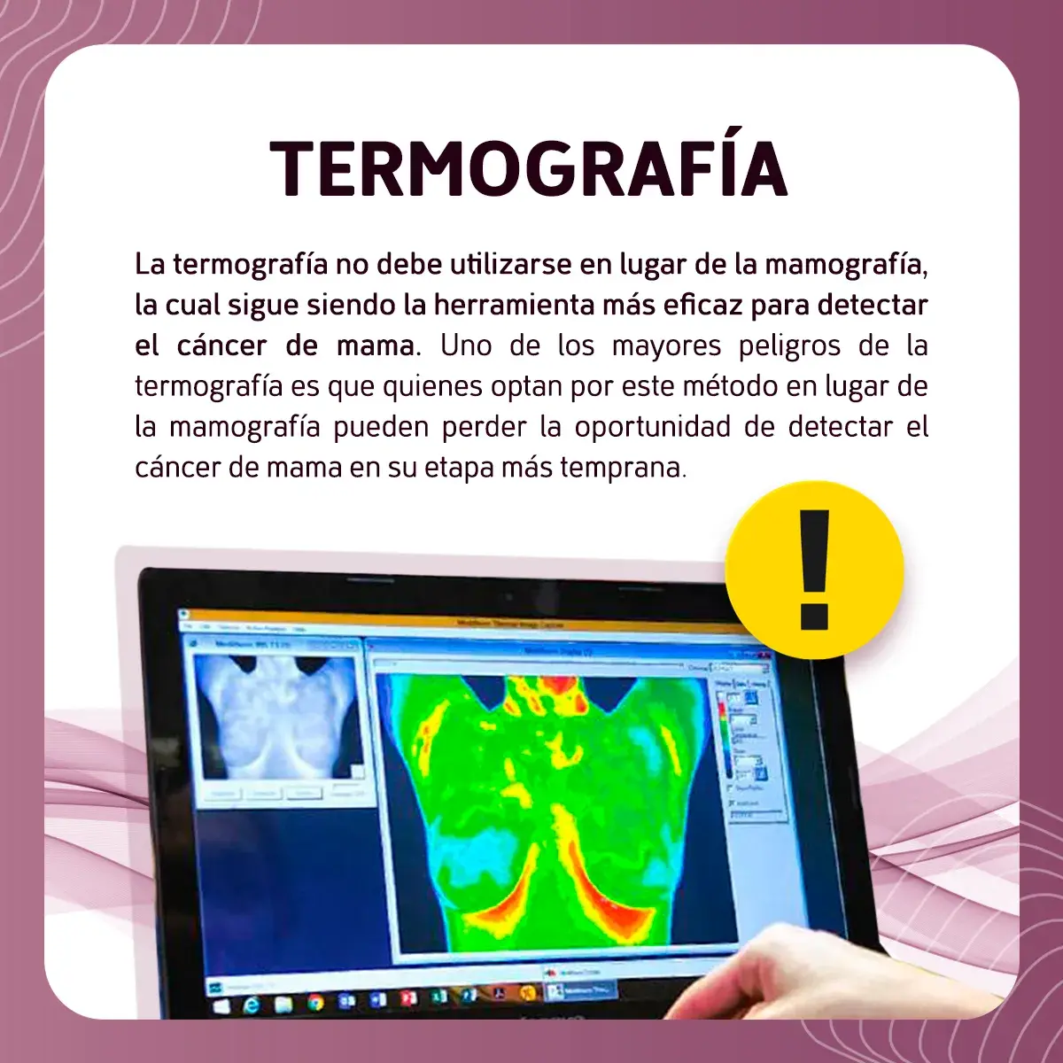 Técnicas más comunes para diagnosticar cáncer de mama (mastografía, ultrasonido, exploración y biopsia)