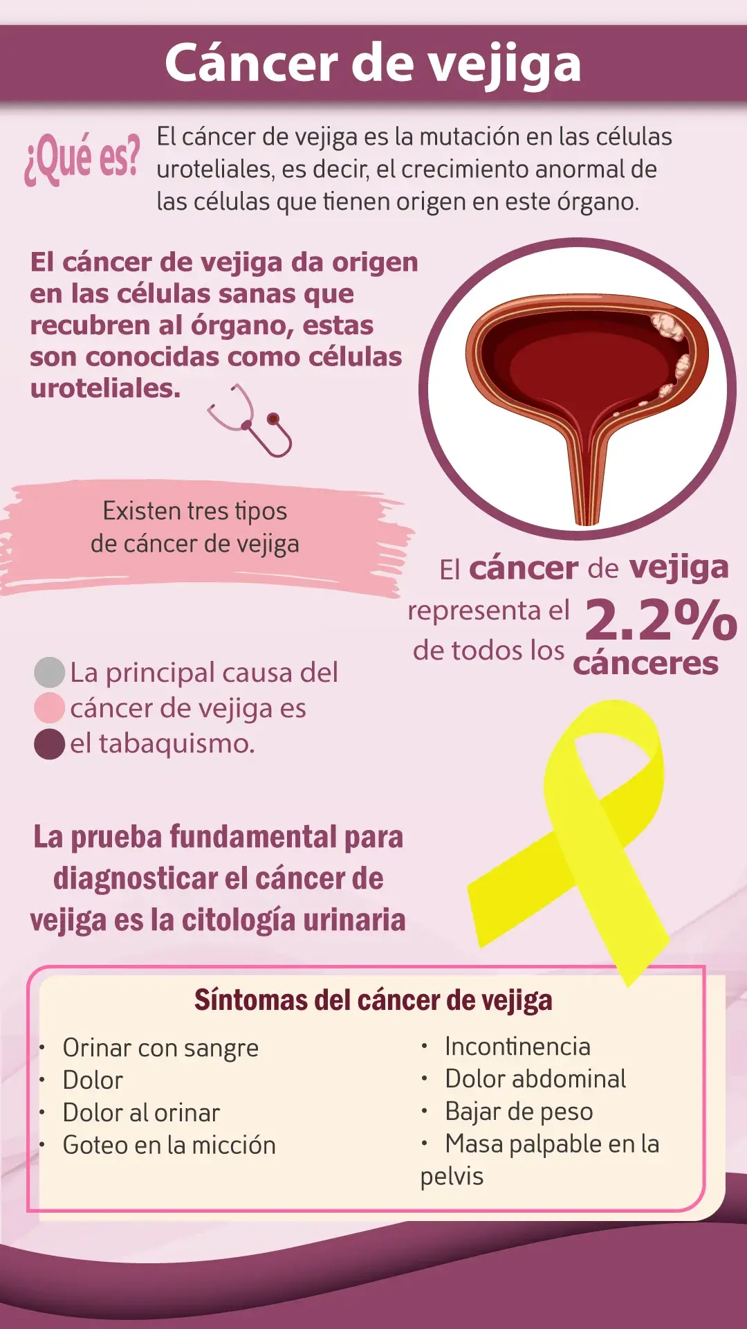 que es el cáncer de vejiga (origen, tipos, causas y síntomas)